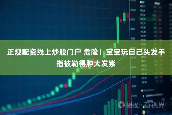 正规配资线上炒股门户 危险！宝宝玩自己头发手指被勒得肿大发紫